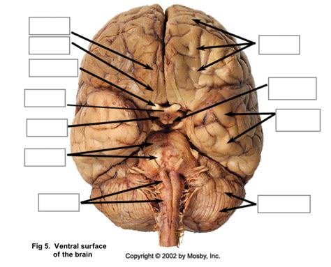 Neuroanatomy Bottom View Diagram Quizlet