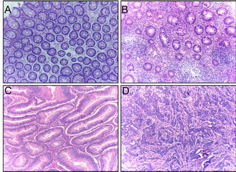 Hematoxylin And Eosin Staining Examples Of Hematoxylin And Eosin H E