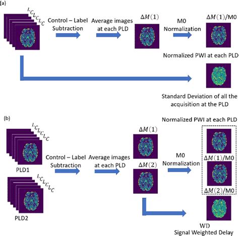 Figure From Deeply Accelerated Arterial Spin Labeling Perfusion Mri