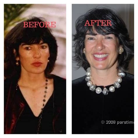 Christiane Amanpour Plastic Surgery Photos [Before & After] - Surgery4