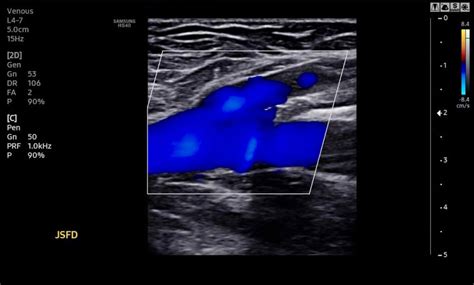 Quem Faz Ultrassom é O Que