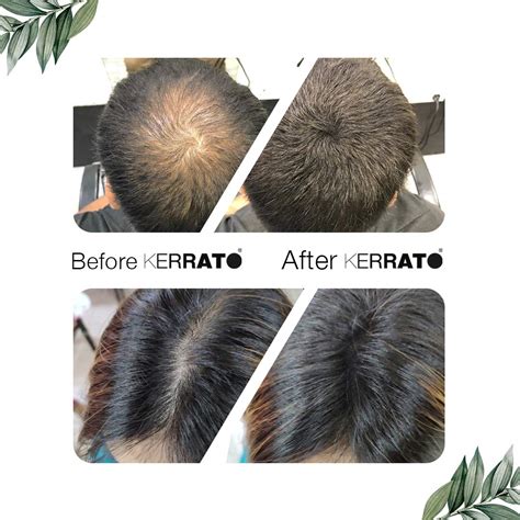 Kerrato Hair Fibres Black For Thinning Hair Black Natural G