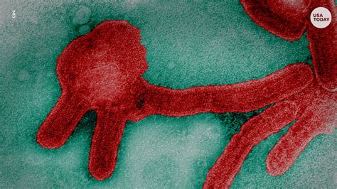 Marburg Virus Outbreak In Equatorial Guinea Heres What To Know