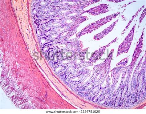 Small Intestine Cross Section Under Microscope Stock Photo 2224751025 ...