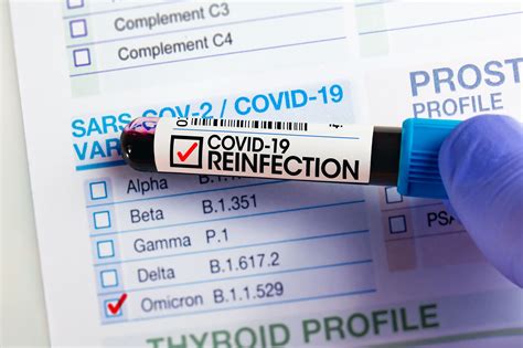 The Pathology Of Covid 19 Reinfection