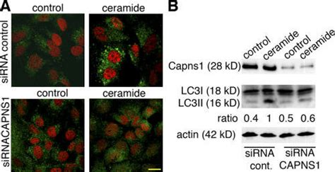 Capns Depletion Is Coupled To A Block In Autophagosome Formation In