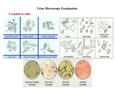 SOLUTION: Urine microscopic examination - Studypool