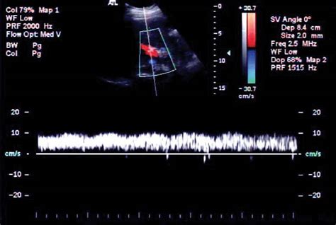 Abdominal Vascular Sonography Lange Review Ultrasonography