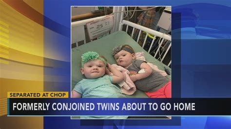 Formerly Conjoined Twins Almost Ready For Home After Chop Surgery 6abc Philadelphia