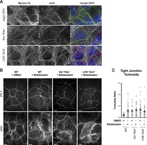 Imaging Of Junctional And Apical Defects With Myo Iia Localization And