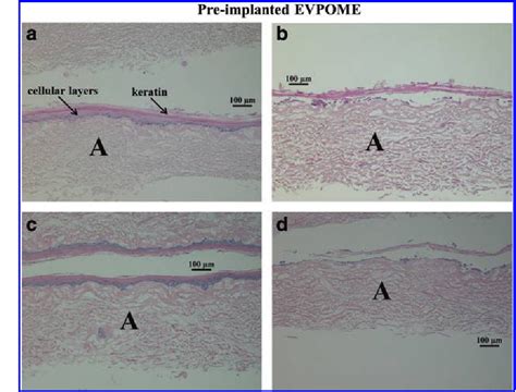 Figure 1 From Human Oral Mucosa Tissue Engineered Constructs Monitored