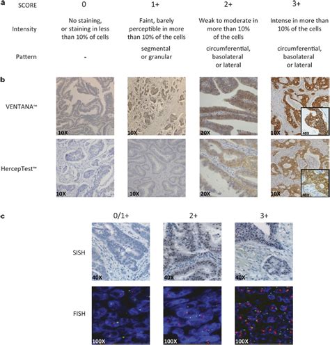 Initial Criteria For Erbb2 Determination Of Immunohistochemistry Scores