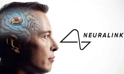 Elon Musk Neuralink Implants Brain Chip In First Human Gss Media