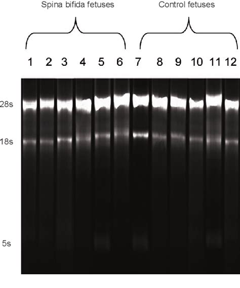 Figure From Altered Microrna Expression Profiles In A Rat Model Of