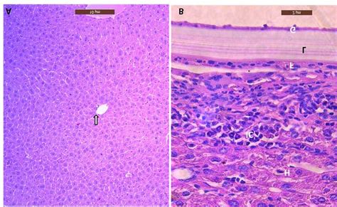 (A) Sections from the liver of the control uninfected mouse showed ...