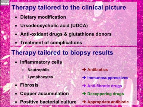 Liver Disease: Treatment Flashcards | Quizlet