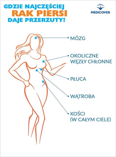 Jak Wygl Da Rak Piersi Objawy Rozpoznanie Leczenie Twoje Zdrowie