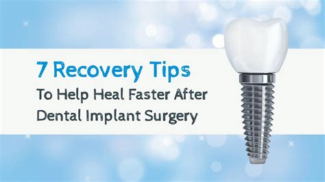 7 Dental Implant Surgery Recovery Tips Youtube