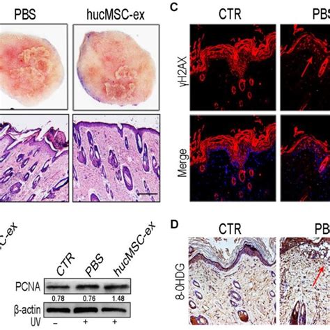 Hucmsc Ex Protect Skin Cell From Oxidative Stress In Vivo A