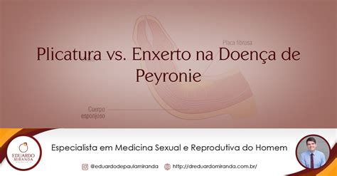 Plicadura Vs Enxerto Na Doença De Peyronie Dr Eduardo Miranda