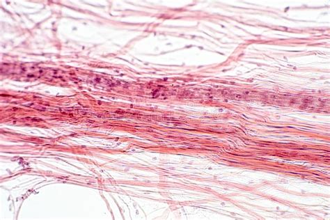 Reticular Connective Tissue Labeled