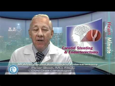 Heart Minute Mi After Carotid Stenting And Endarterectomy Youtube