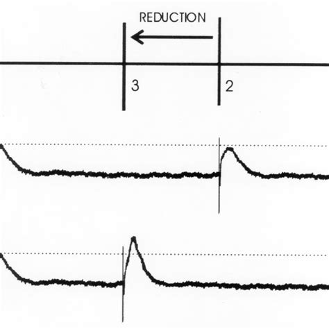 Schematic representation of Long Term Potentiation (LTP) and Long Term ... 