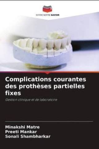 Complications Courantes Des Proth Ses Partielles Fixes Literatura