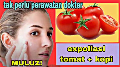 Cuma Tomat Dan Kopi Cara Memutihkan Wajah Dan Menghilangkan Flek Hitam Secara Alami Youtube