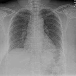 Comparison between a medical image and a natural image. (a) Represents ...