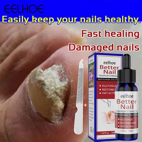 Eelhoe Fungal Nail Repair Essence Foot Toe Nail Anti Fungal Solution