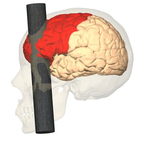 Frontal Lobe: Causes, Picture, Symptoms And Treatment