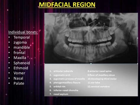 Orthopantomogram.ppt