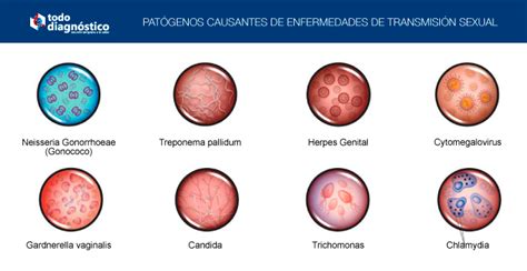 Diagnóstico sindrómico de ETS Todo Diagnóstico