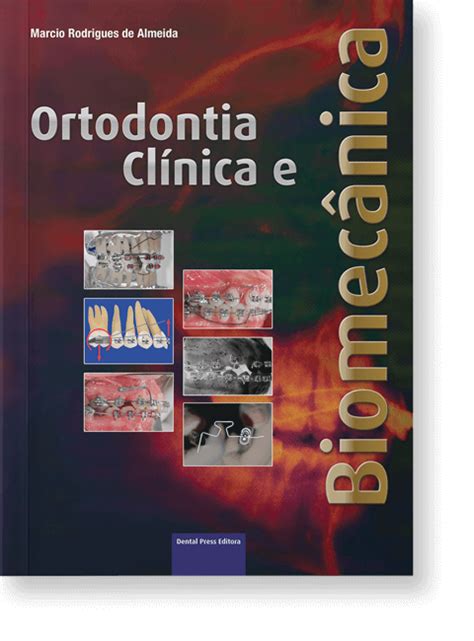 Ortodontia Clínica e Biomecânica Dental Press Books