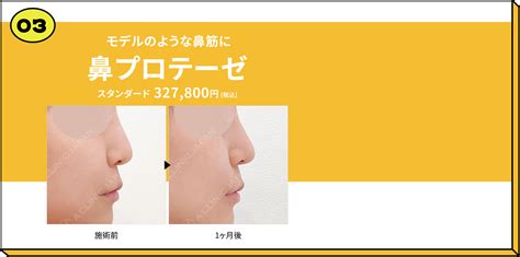 A Clinic監修 自分に合う施術がすぐわかる！かんたん4問 鼻のお悩み診断 美容整形のa Clinic 美容外科 美容皮膚科 形成外科