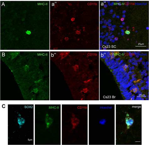 Mhc Class Ii Mhc Ii Cd B And Sox Expression In Human Fetal Cns