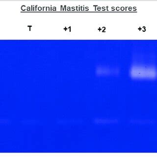 Image Of Matrix Metalloproteinase MMP 2 And MMP 9 Bands In The Raw