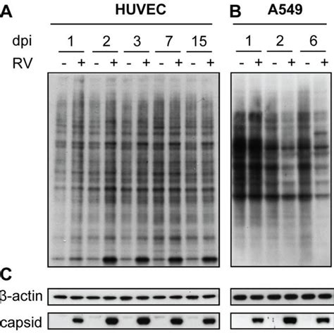 Lack Of Global Cellular Protein Synthesis Shut Off In Infected Huvec