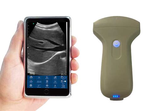 3C Convex Palm Doppler Ultrasound SonoStar Manufacturer Of Palm