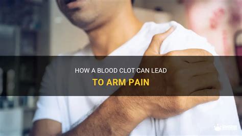 How A Blood Clot Can Lead To Arm Pain Medshun