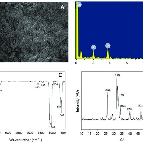 Characterization of nHAP by SEM bar 20 µm A EDS B FTIR C