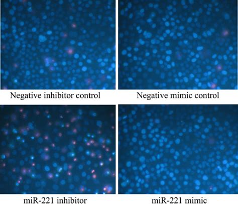 Effect Of MiR 221 On Cell Growth And Apoptosis Of HCC HepB3 Cells By