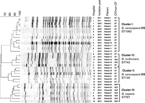 Pfge Dendrogram Of Xbai Digested Genomic Dna Showing Four Uk B Cepacia