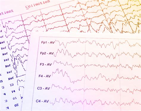 Eeg Test