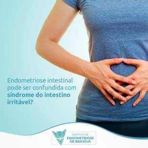 Endometriose Intestinal Pode Ser Confundida S Ndrome Do Intestino