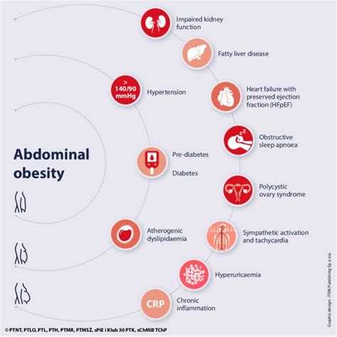 Metabolic Syndrome Treatment Algorithm Download Scientific Diagram