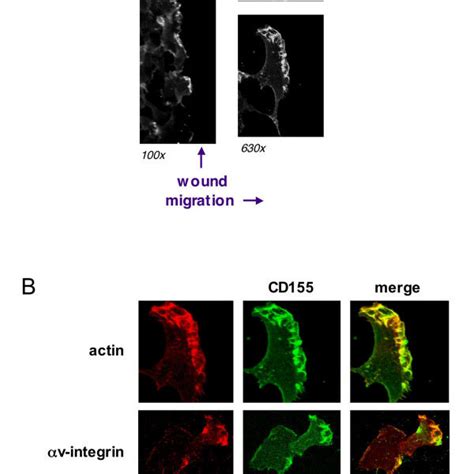 Cd Is Recruited To The Leading Edge Of Migrating Cells And