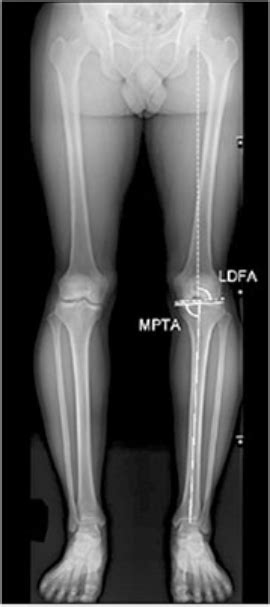 CIOS Clinics In Orthopedic Surgery