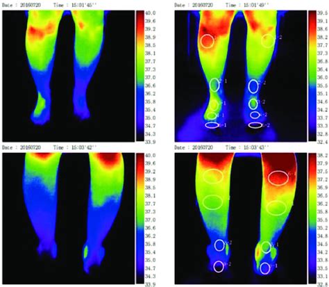 The digital infrared thermal imaging demonstrated the significant ...